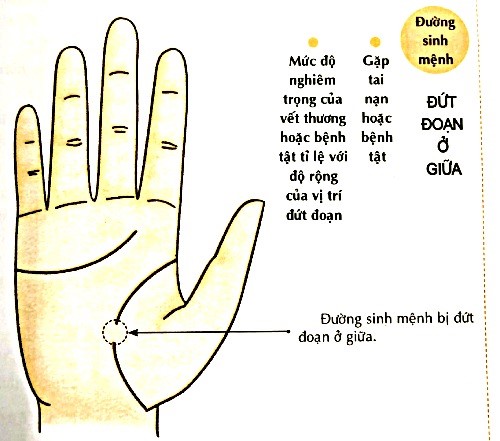 Phương Pháp Đọc Và Hiểu Đường Sinh Mệnh Trong Nhân Tướng Học