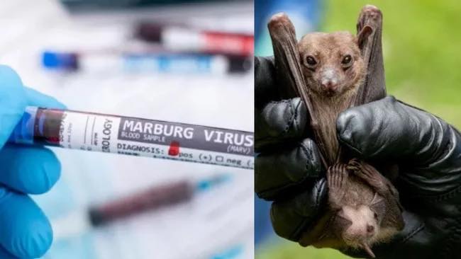 Virus Marburg gây chết 9 người ở Tây Phi, vật chủ lây nhiễm là dơi (ảnh nguồn bệnh viện Chợ Rẫy).