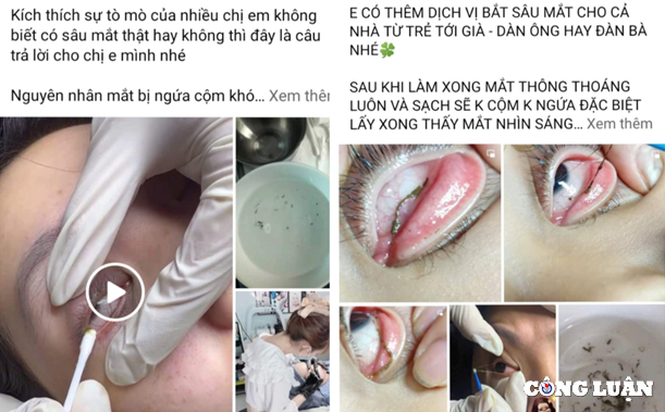 Trên mạng xã hội, dịch vụ “bắt sâu mắt” đang được giới thiệu rầm rộ.