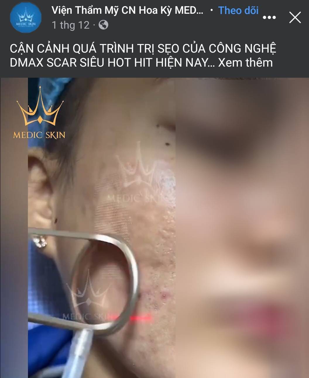 tp hcm tham my vien medic skin quan 10 cung cap dich vu tham my chui hinh 3