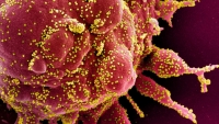 Các quốc gia khẩn cấp phòng thủ khi đột biến của virus SARS-CoV-2 gia tăng