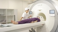 Không có quy định chi phí chụp MRI là công nghệ cao nên BHYT không chi trả