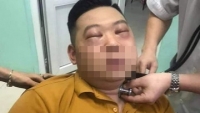 Thái hành, nam thanh niên ở Phú Thọ bị sốc phản vệ