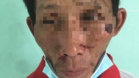 Đã bắt được nghi phạm gây cháy chi nhánh ngân hàng ở Kiên Giang