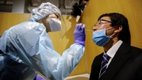 Nhật Bản phát triển hóa chất xét nghiệm, phát hiện biến thể Delta
