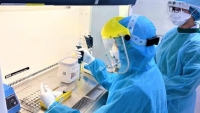Hà Nội công khai mức giá xét nghiệm SARS-CoV-2 bằng kỹ thuật Realtime RT-PCR