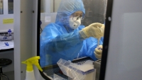 Huyện đầu tiên của Hà Tĩnh triển khai xét nghiệm SARS-CoV-2 bằng PCR