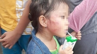 Bắt giữ cô giáo bạo hành bé gái 5 tuổi ở nhóm trẻ Ánh Sao Vàng 