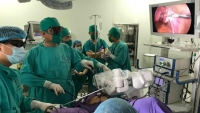 Ứng dụng cánh tay robot trong phẫu thuật nội soi điều bệnh lý Sản Phụ khoa, Nhi khoa tại Bệnh viện Sản Nhi Quảng Ninh