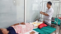 Tuyên Quang: Tự ý đắp thuốc Nam gây bỏng nặng cả hai chân