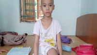 Xót xa bé gái 7 tuổi bị cắt bỏ một chân do mắc bệnh ung thư xương