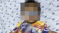 TP. HCM: Bé trai 30 tháng tuổi nguy kịch do uống phải dung dịch tẩy mực in