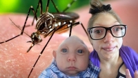 Virus Zika nguy hiểm như nào đối với phụ nữ có thai