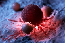 Nghiên cứu: Gần một nửa ca tử vong ung thư có thể ngăn ngừa được