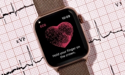 Apple thâu tóm thêm một startup công nghệ chuyên về giám sát sức khỏe