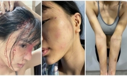 Người mẫu Khả Trang bị bạo hành dã man