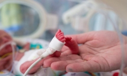 Bệnh viện Phụ sản Hà Nội: Cứu sống thành công bé gái sinh non nặng 400g