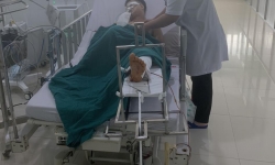 Kon Tum: Thiếu niên 15 tuổi phóng xe máy “thông chốt”, đâm CSGT trọng thương