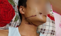 Uông Bí, Quảng Ninh: Nam thanh niên “thập tử nhất sinh” vì bị dây viễn thông ngoài đường siết cổ