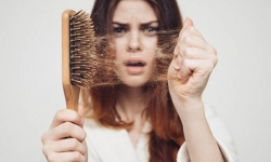 Những thói quen xấu khiến bạn bị rụng tóc, hói đầu