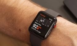 Chức năng theo dõi nhịp tim của Apple Watch khiến người dùng lo lắng