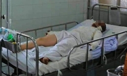 Hà Nam: Đốt pháo tự chế một người bị thương nặng