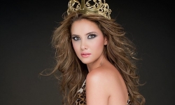 Hoa hậu hoàn vũ Colombia - Daniella Alvarez phải cưa chân vì biến chứng