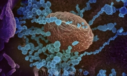 Mã gien virus SARS-CoV-2 gây bệnh ở Hải Dương và Đà Nẵng giống nhau