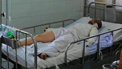 Hà Nam: Đốt pháo tự chế một người bị thương nặng