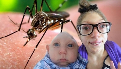 Virus Zika nguy hiểm như nào đối với phụ nữ có thai